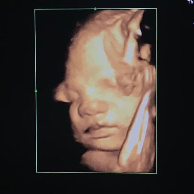 Y ahora que está a semanas de dar a luz, por fin pudo conocer la cara de su bebé.