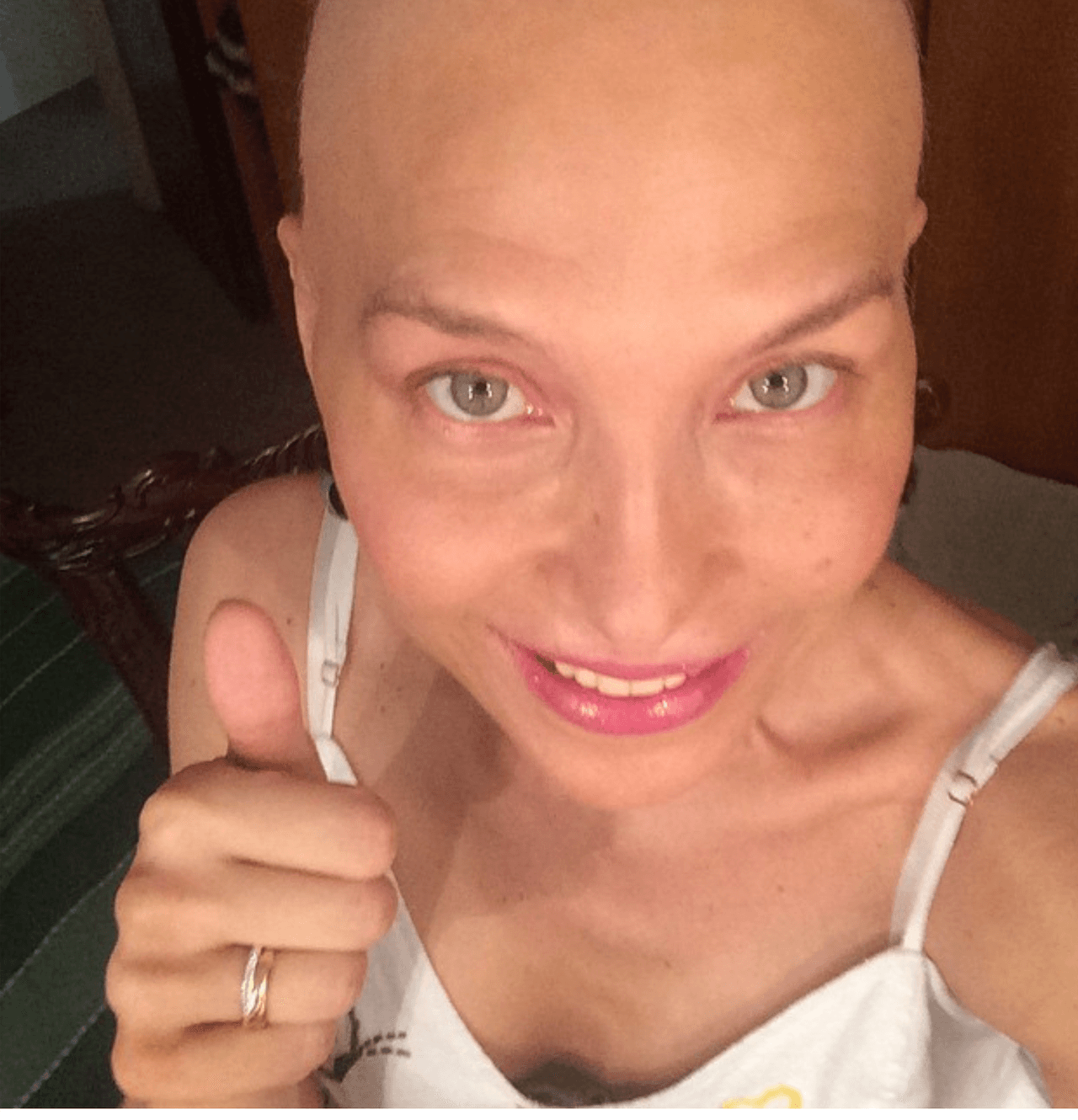 "No me importó mostrarme sin cabello, quería que vieran como una mujer luchaba día a día para tener lo más importante, vida", señaló la actriz en una entrevista televisada en Colombia.