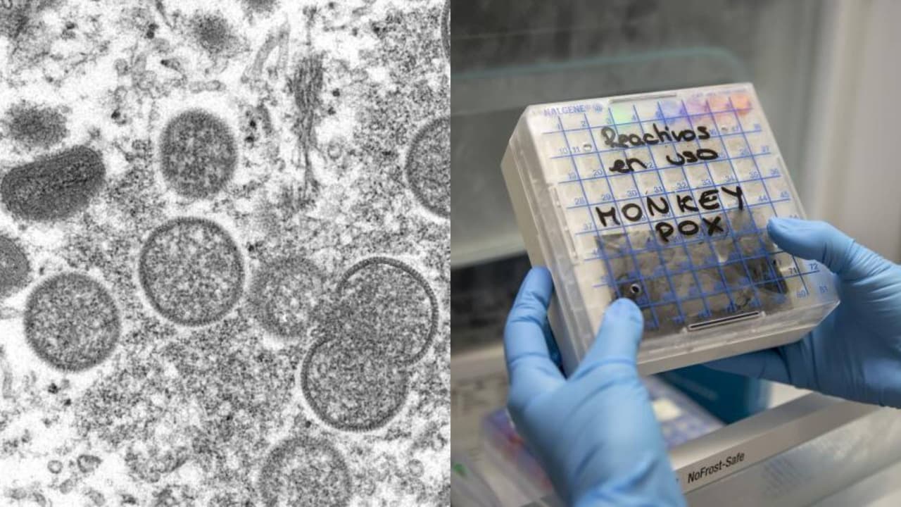 Detectan viruela del mono en aguas residuales de Sacramento