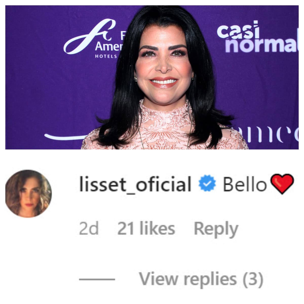 <b><a href="https://www.univision.com/entretenimiento/celebridades/lisset-y-lisardo-juntos-otra-vez-pero-solamente-por-su-hija-fotos#66dd8fea0001" target="_blank">Lisset</a>, </b>otra de sus colegas de la telenovela, le dejó un mensaje al ver su cambio de look. 
<br>