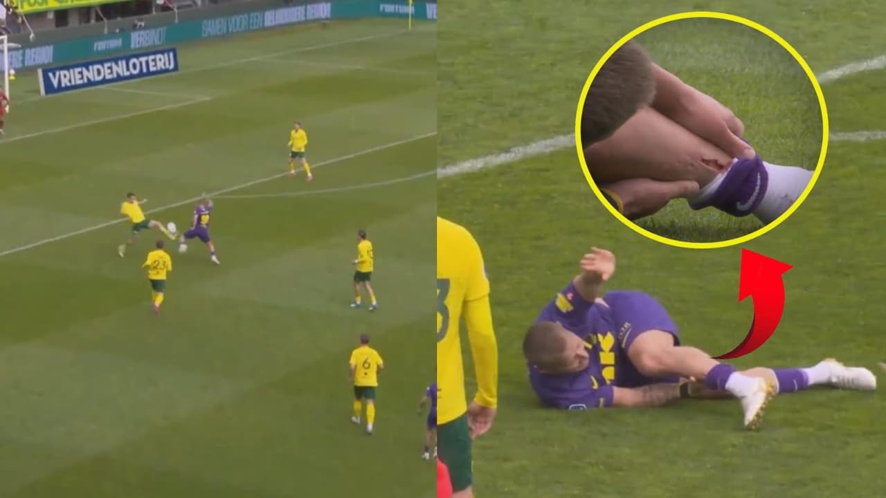 Impactante lesión de Holtby estremece la Eredivisie