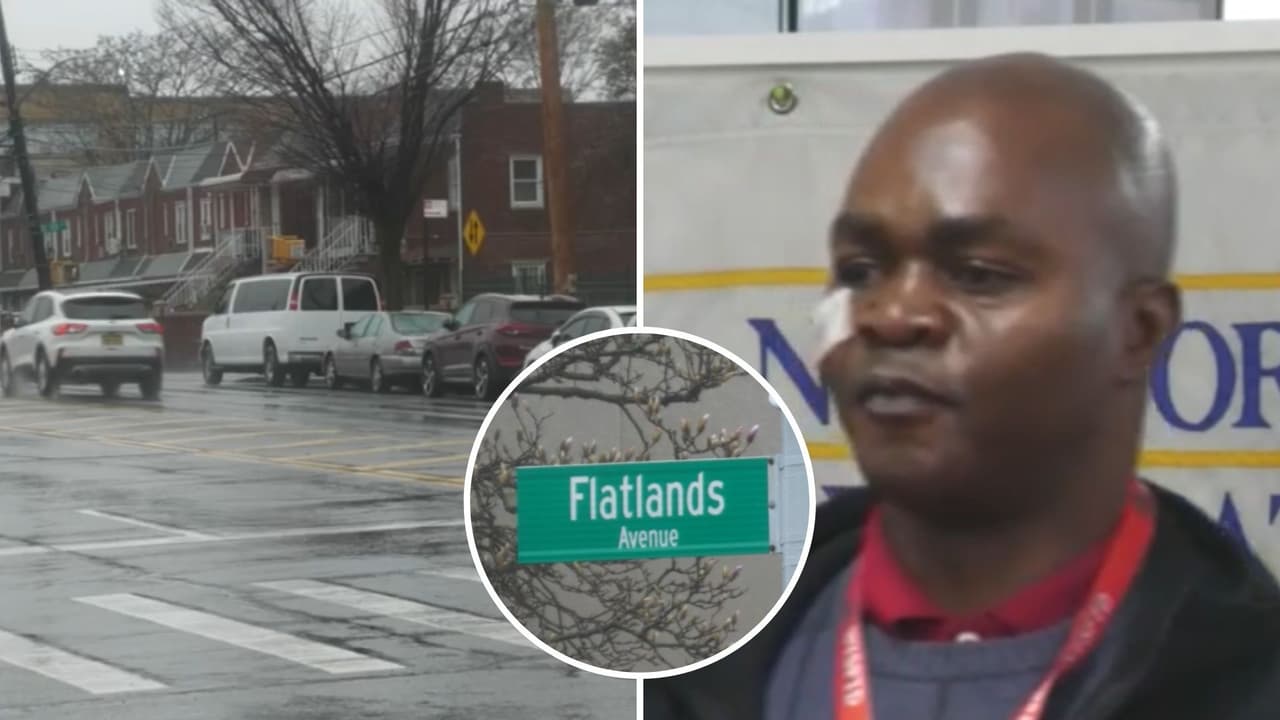 Taxista sobrevive a disparo en la cara durante asalto en Brooklyn: "voy a tener que matarte”, le dijo pasajero