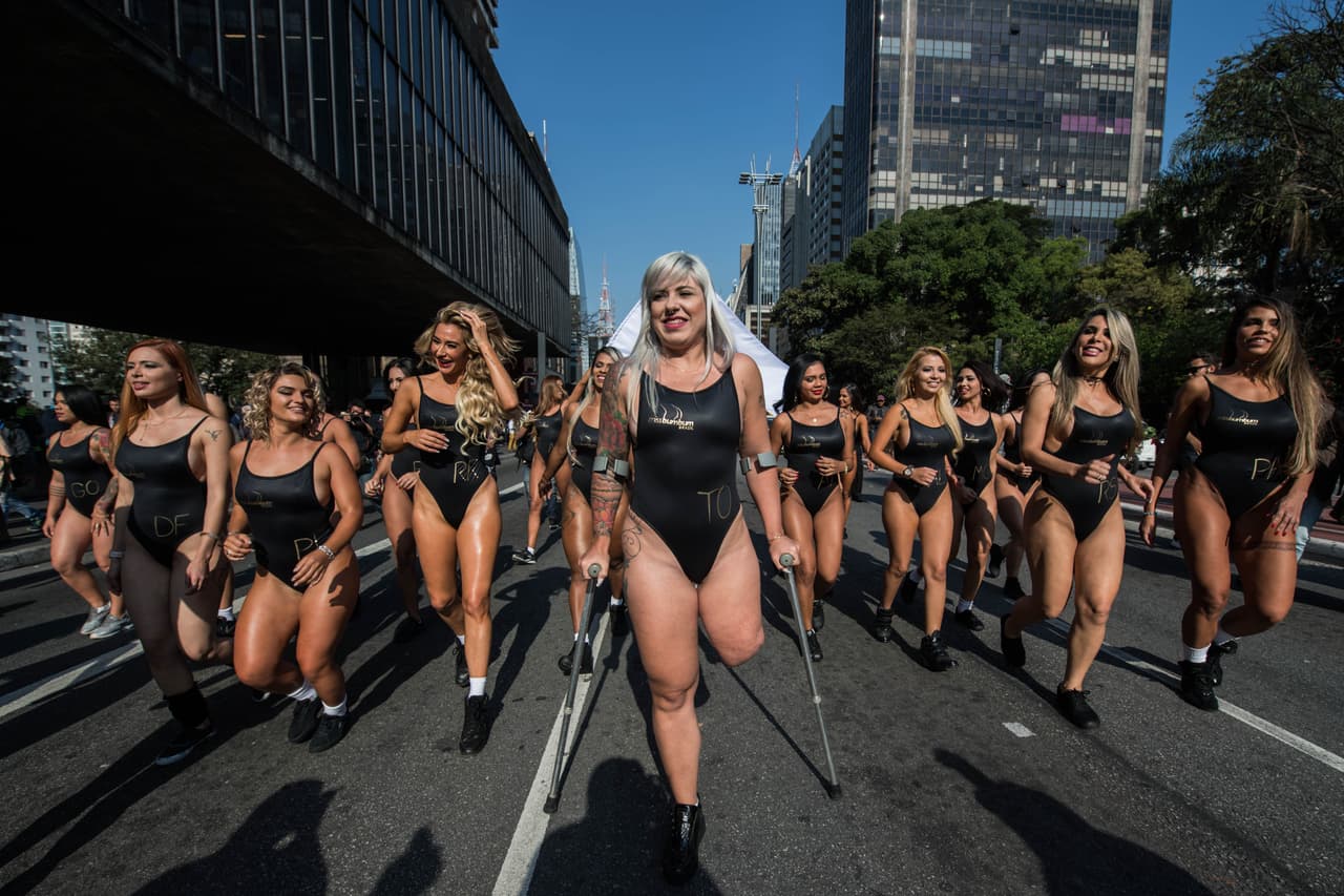 Ella representa al estado de Tocantins, en la región norte de Brasil y sufrió la amputación de una pierna.