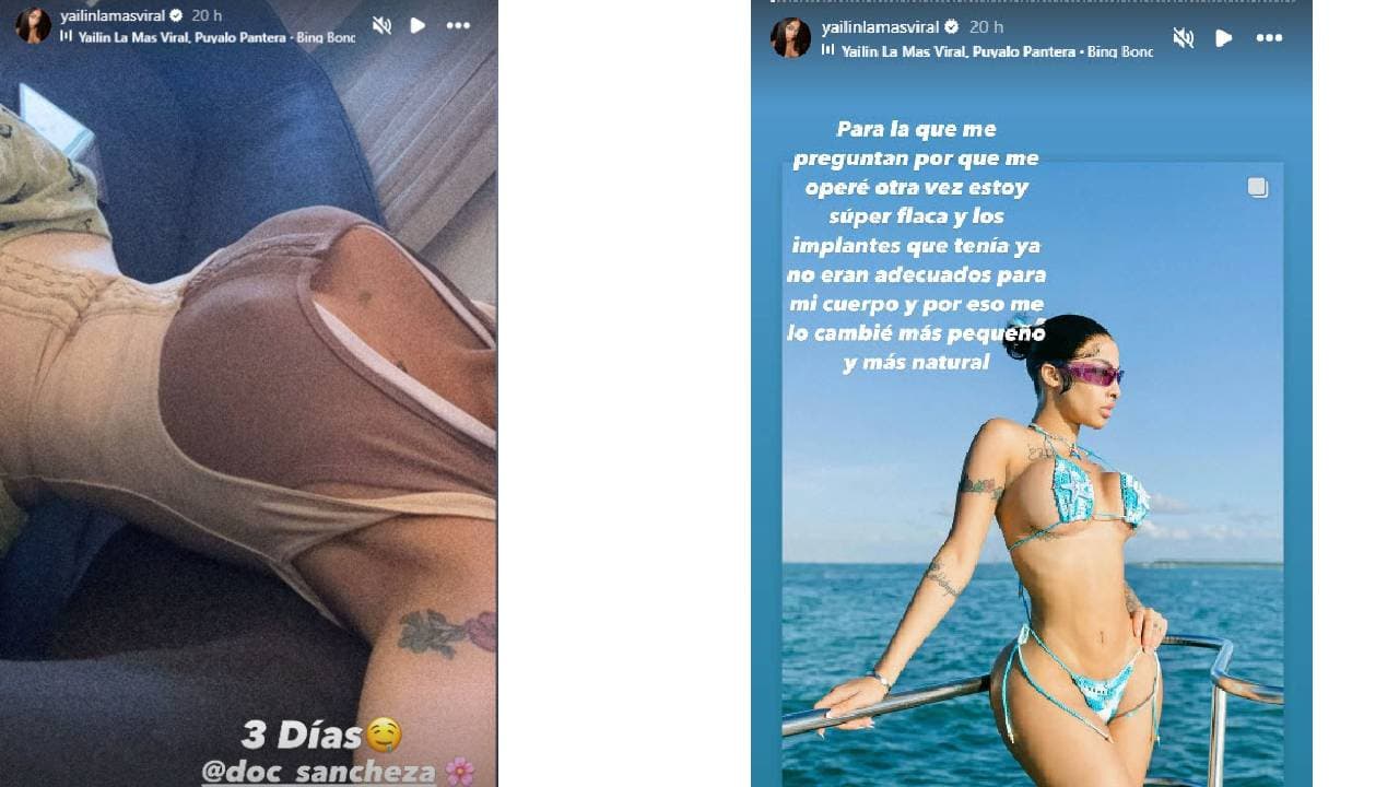 Yailin La Más Viral se redujo los implantes mamarios.