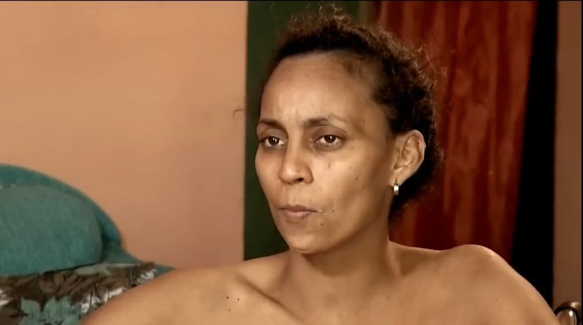 “Después de que me ha dado la enfermedad se me han quitado todas las ganas de vivir”, dice Ana, quien recuerda cuando comenzó a sentir que las piernas se le dormían y simplemente ya no pudo caminar. 
<br>