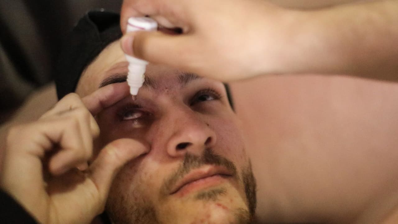 FDA retira gotas para los ojos: incluyen productos vendidos en estas tiendas de San Antonio