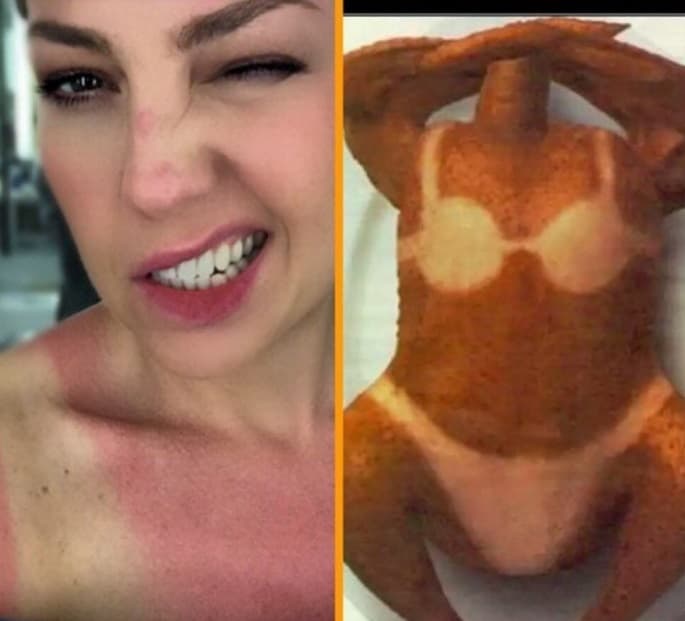 Y las veces que ha sufrido un poco, también puede ver las cosas con humor. Aquí, quemadita como un pollo tostado al horno.