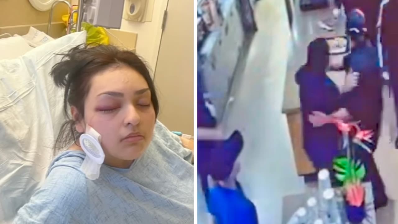 Bianca Palomera, trabajadora hispana, pierde un ojo al tratar de defender a un chico con discapacidad