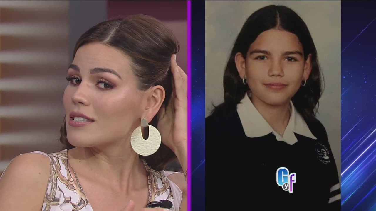 "Operarme las orejas es lo mejor que he hecho en mi vida", dijo felizmente, pues en su adolescencia no la pasó nada bien por el bullying que sufrió.