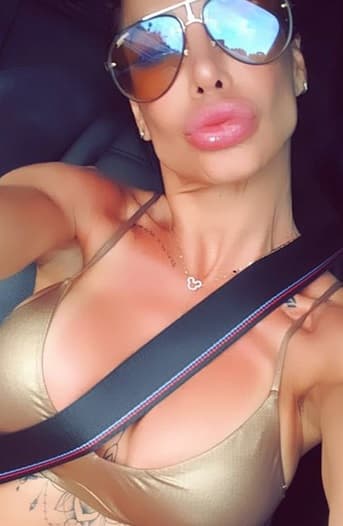 La cubana justificó su más reciente tratamiento en los labios: "A mí me gusta, uno siempre tiene que buscar cómo se ve, a mí me encantaba tener 
<b><a href="https://www.univision.com/famosos/federico-diaz-dice-bromeando-que-casi-deja-de-seguir-en-instagram-a-su-ex-lis-vega-porque-no-la-reconocio-fotos" target="_blank">los labios carnosos</a></b>, yo tenía una cicatriz aquí de una caída en el teatro y yo quería que la cicatriz no se me viera y fue complicado, estoy feliz con mis labios".
<br>