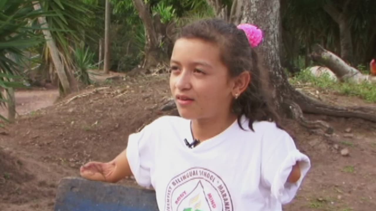 Una niña tocó un cable de alta tensión y se quedó sin brazos