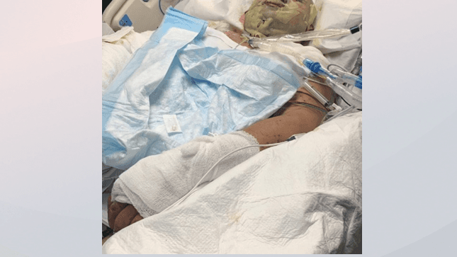 Víctima de explosión en Durham