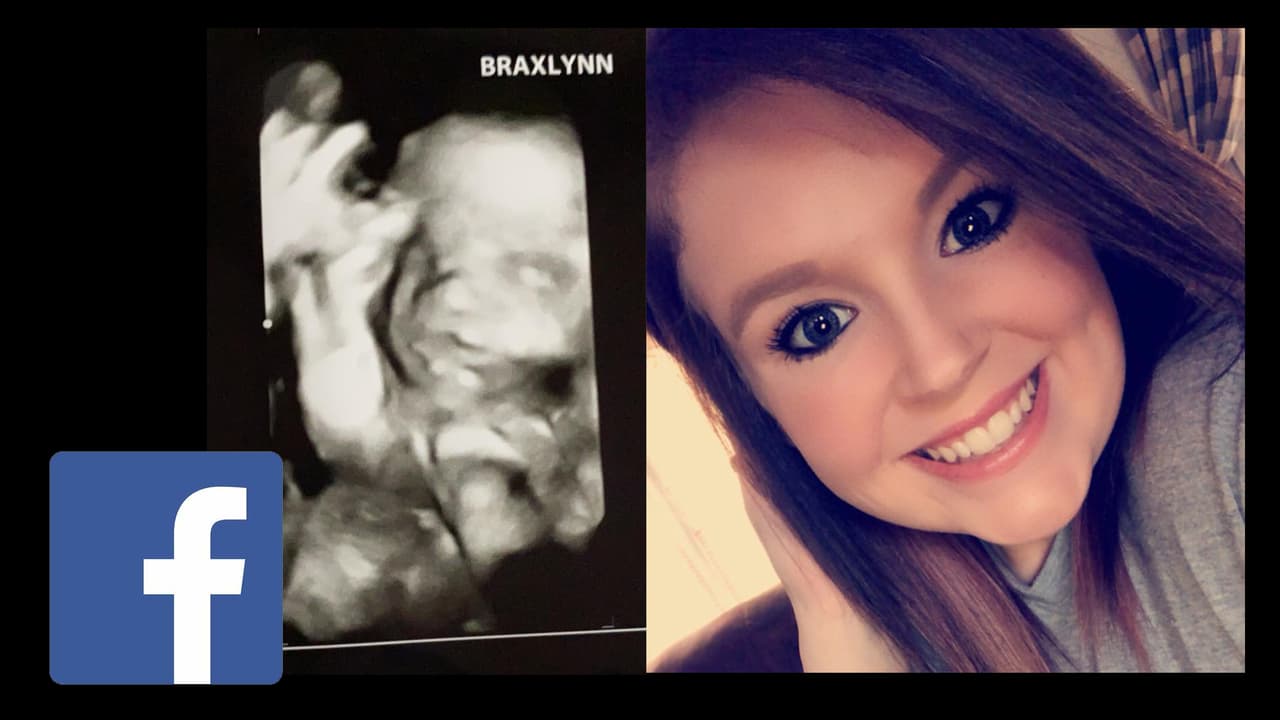 Reagan Hancock y el ecosonograma de la criatura.