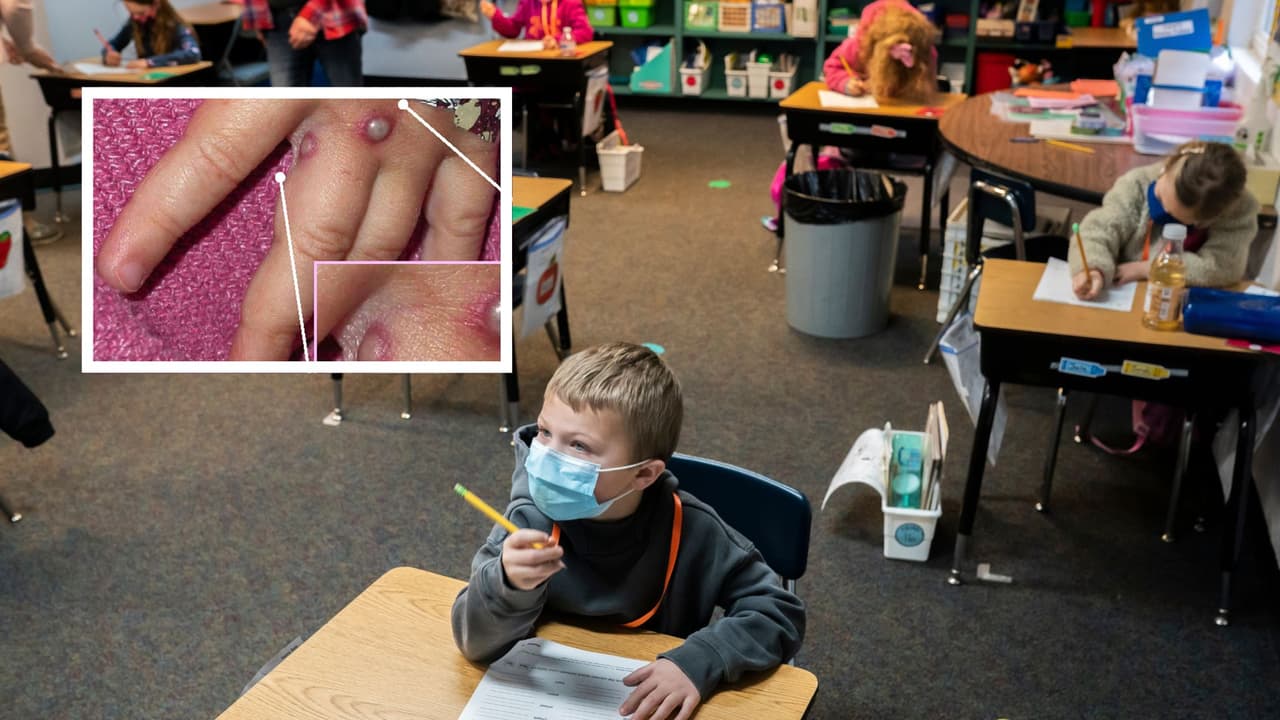 Viruela del mono y regreso a clases: así se preparan los distritos escolares del DMV para el nuevo año académico