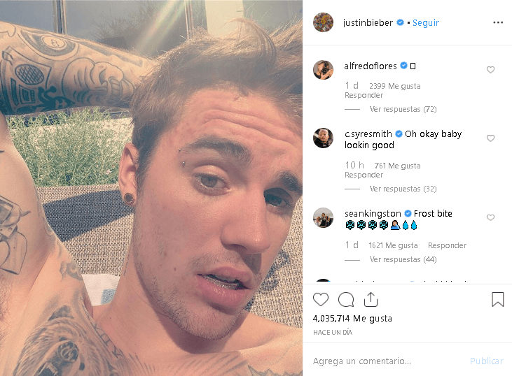 En una publicación hecha en su cuenta de 
<b><a href="https://www.instagram.com/p/B0R14ZUn3c3/" target="_blank">Instagram</a></b>, Justin mostró discretamente una nueva 
<b>férula dental con diamantes incrustados</b>.