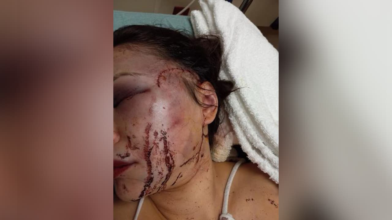 “Me decía que, por qué no le contestaba, que dónde estaba, con quién estaba, que todo era por mi culpa”, continúa la mujer.
<br>