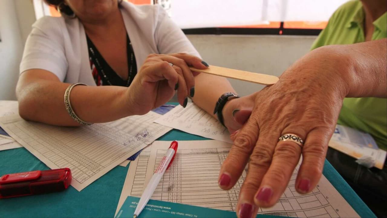 ¿Uno de cada cinco estadounidenses desarrollará cáncer de piel? Cómo prevenir e identificarlos