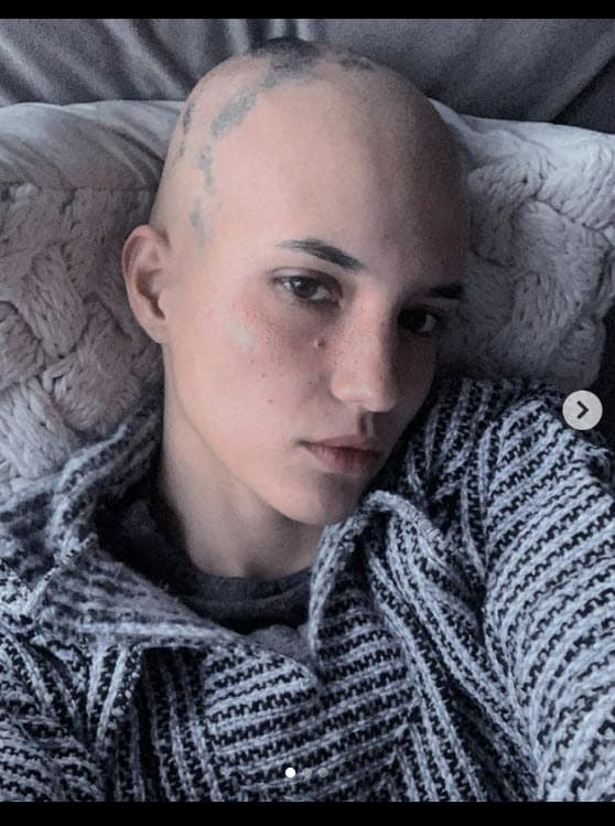 La novia de Camila Araiza la tiene desde que era una niña: "A los 3 años me dijeron que no me estresara porque se me iba a caer el pelo, 
<b>vivía en pánico desde ese momento</b>", ha escrito en Instagram. 
<br>