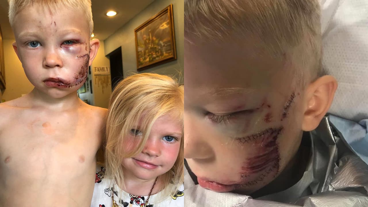 “Si alguien tenía que morir, debía ser yo”: niño salvó a su hermana de un ataque de perro