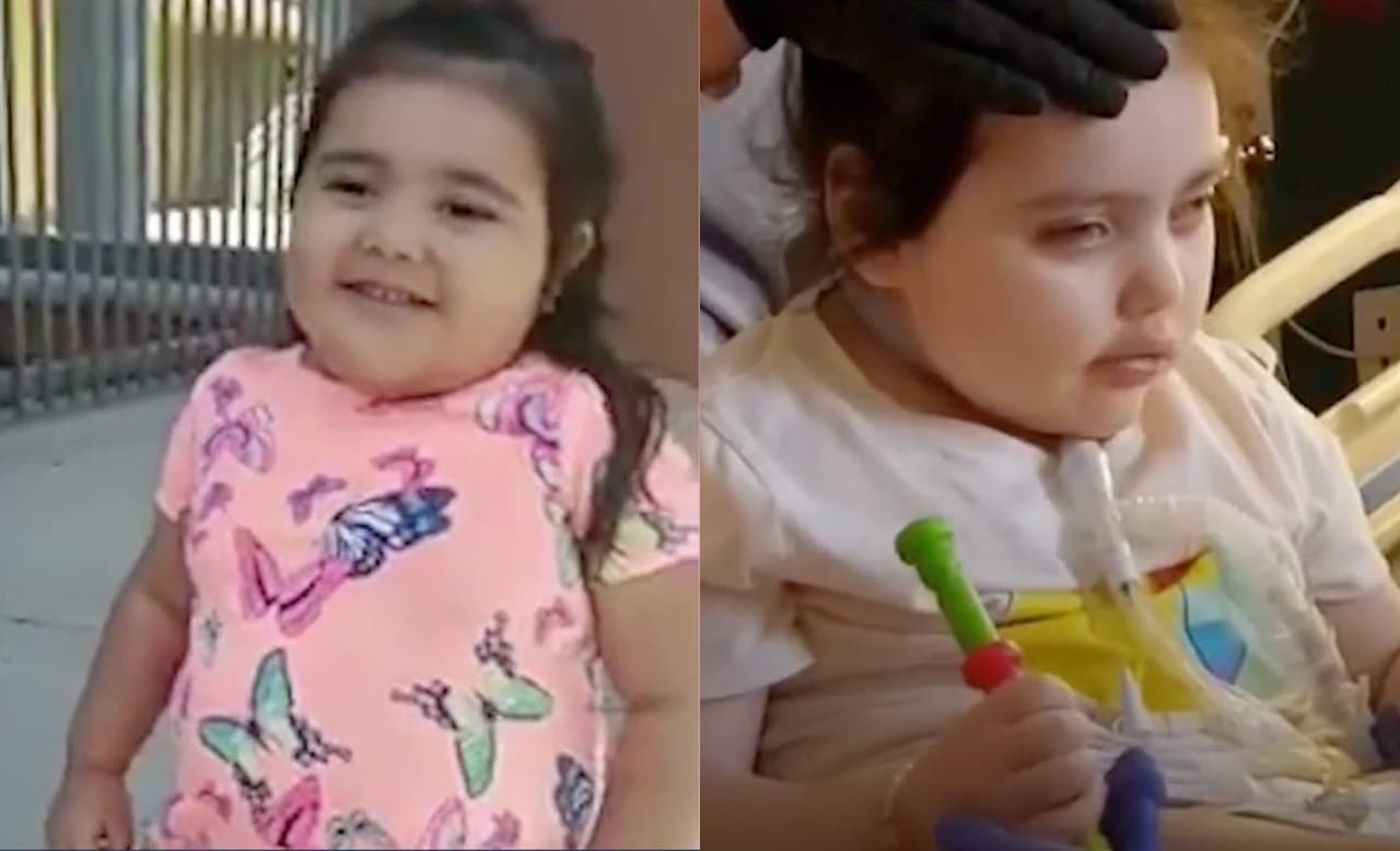 Niña padece rara enfermedad que la cambió por completo: el primer síntoma fue la obesidad