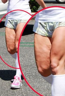 Bueno este sí que es un caso severo... Con nada se la ha podido quitar y ya ni pena le da. ¿De quién estamos hablando?