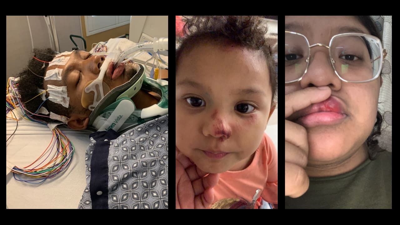 Pide disculpas y termina en coma en un hospital de Phoenix