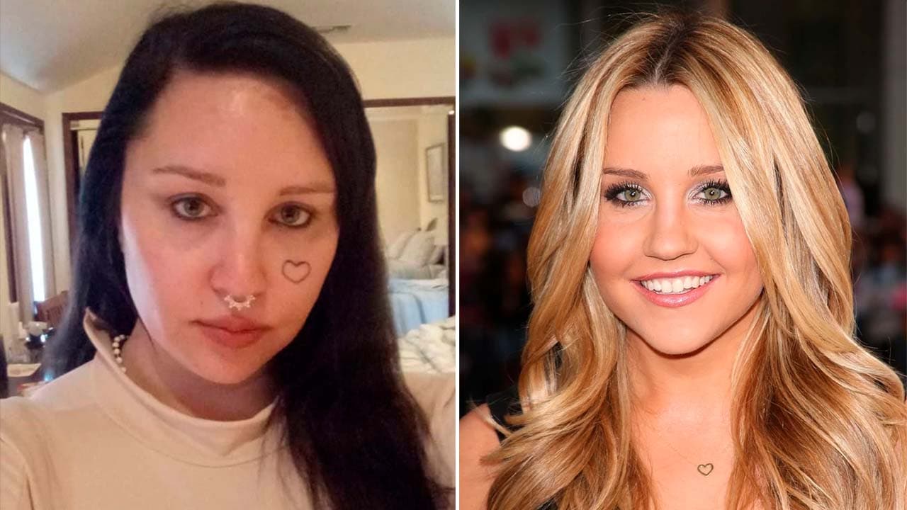 ¿Qué sucedió con Amanda Bynes? Bipolaridad, abuso y otros terribles momentos