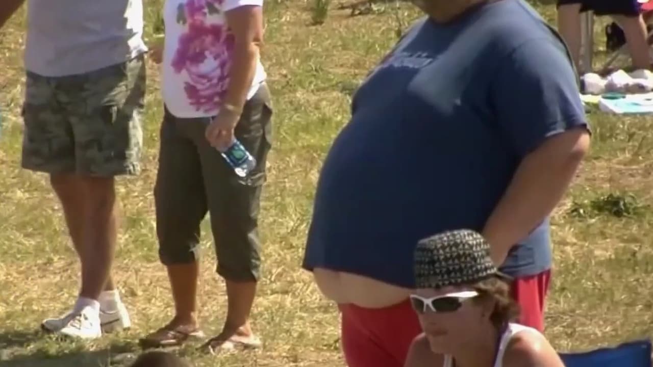 Obesidad está vinculada a una de cada diez muertes por enfermedades infecciosas