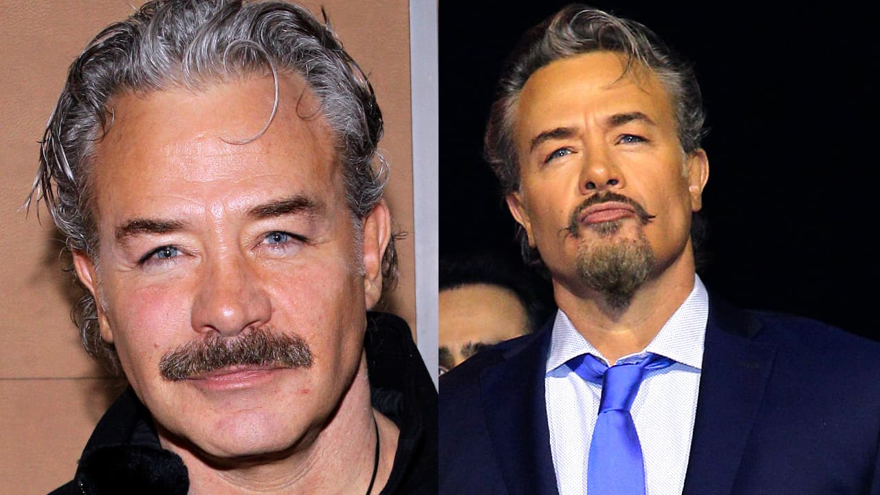 Sergio Sendel recurre a costoso tratamiento antiedad para lucir más joven a sus 59 años: esto vale