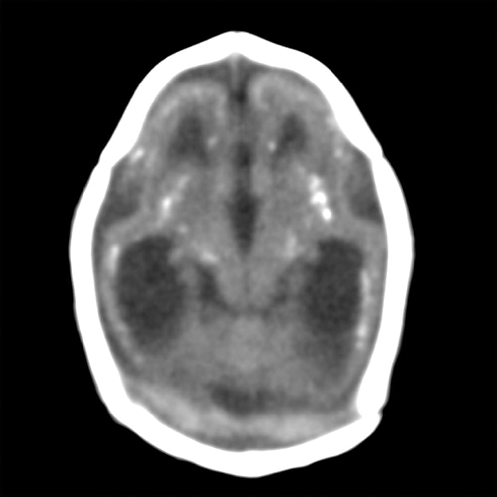 El Instituto de Pesquisa de Campina Grande, Brasil, confirmó que tenía zika.