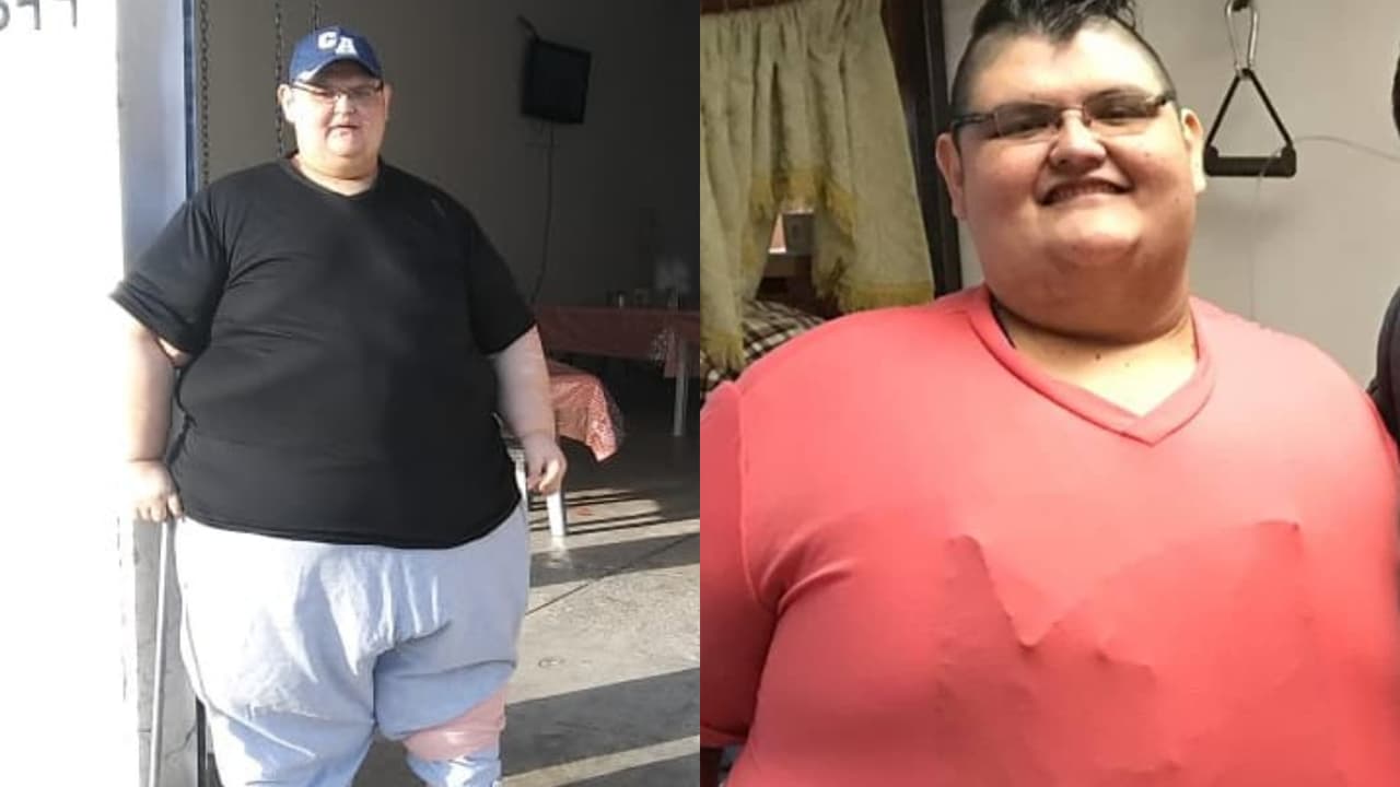 ¿De qué murió el mexicano Juan Pedro Franco, el hombre más obeso del mundo? Esto se sabe
