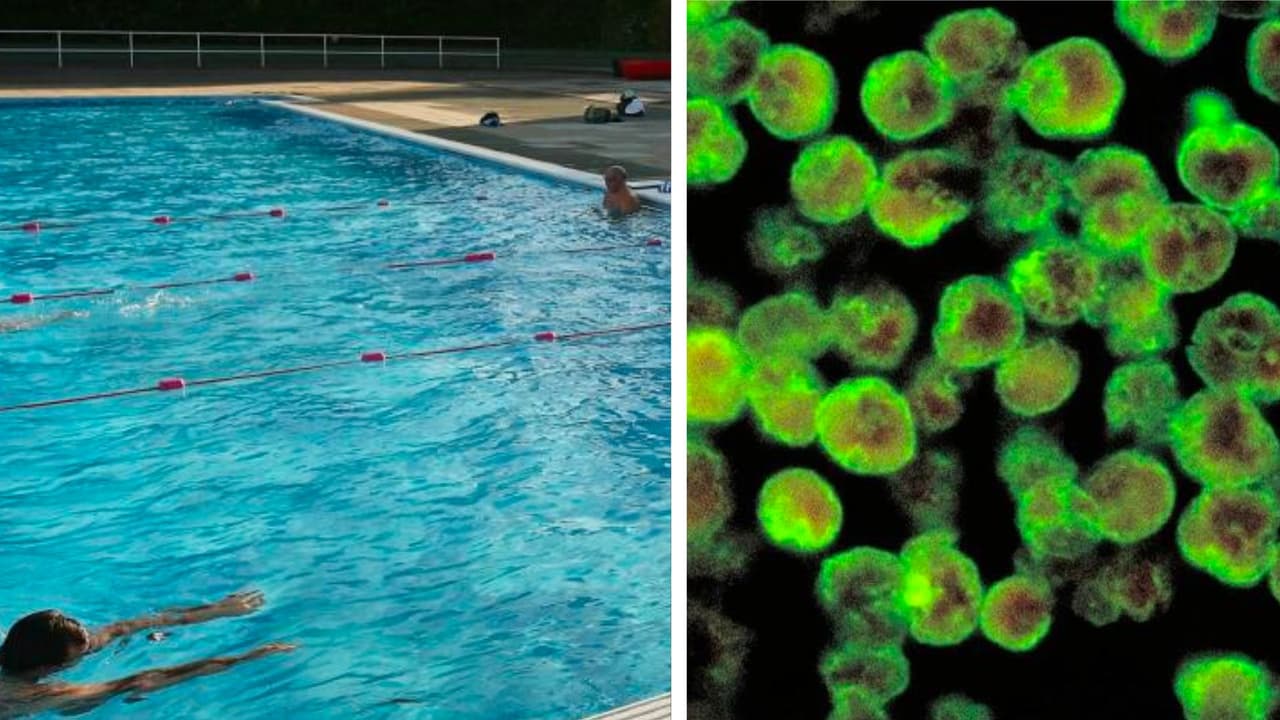 Reabren piscinas y chapoteaderos de Arlington, tras alerta por ameba comecerebros