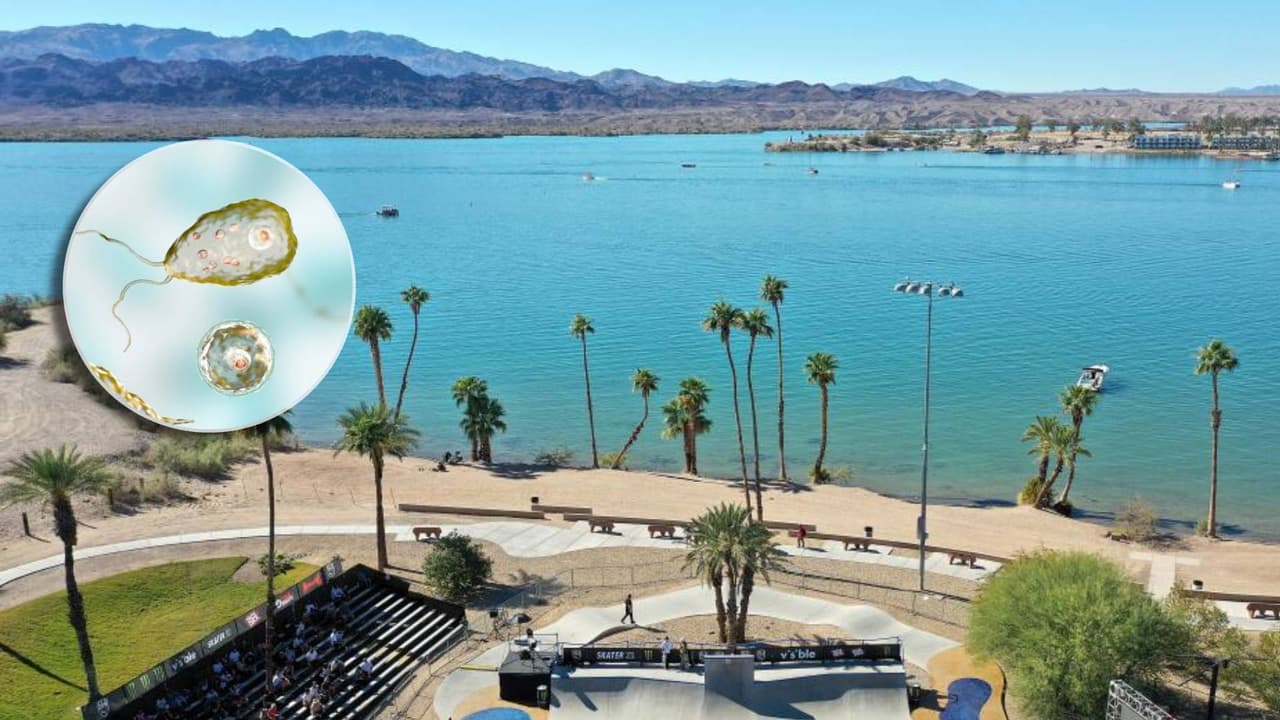 Investigan un posible caso de ameba come cerebros en el condado de Mohave