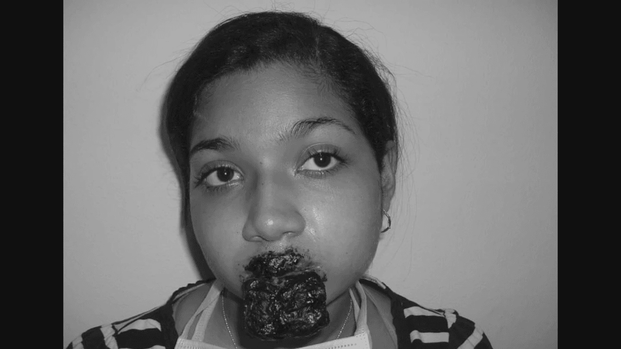 Le salieron llagas en su boca y piernas: joven tras consumir medicamento adulterado