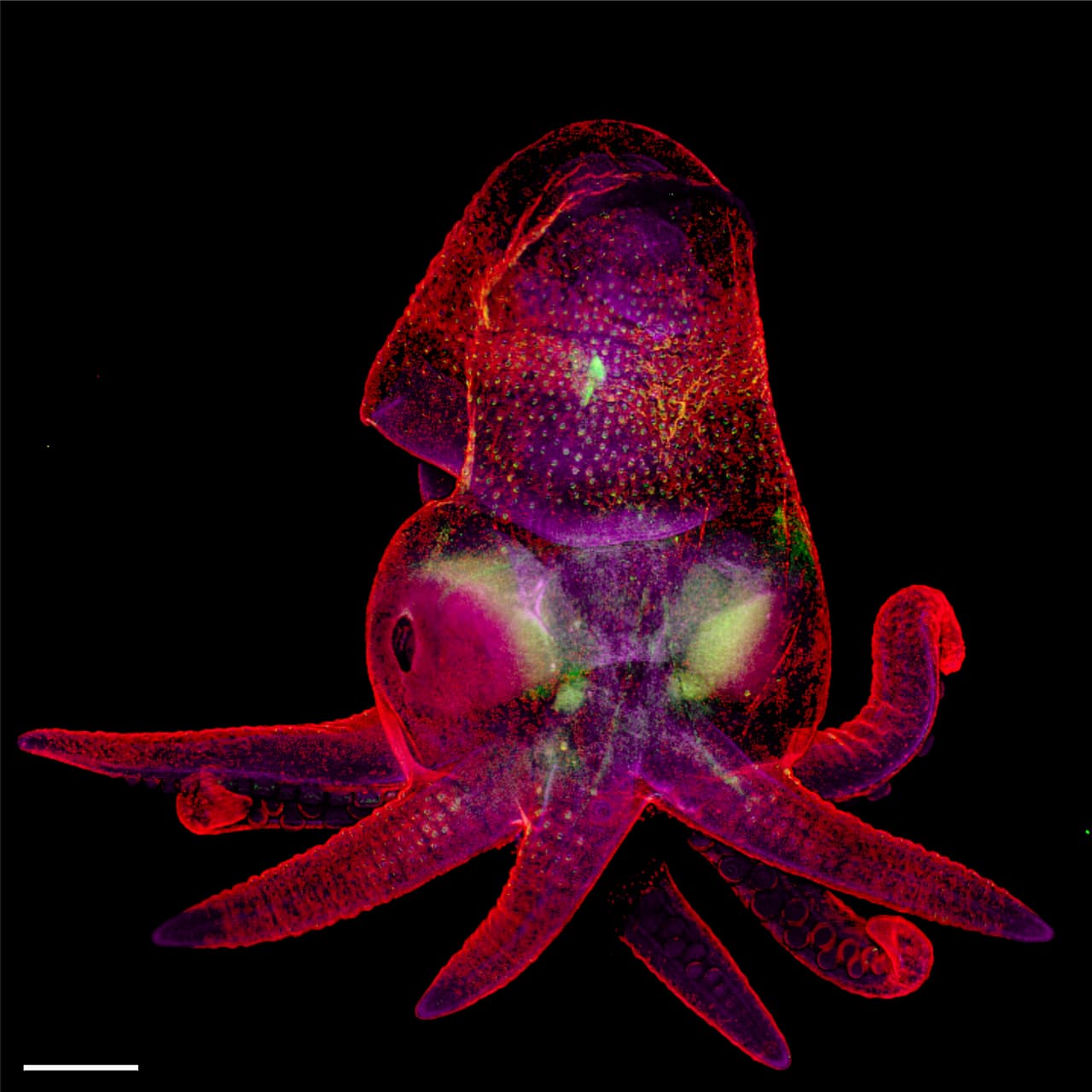 <b>Embrión de pulpo.</b> Al igual que la ganadora, esta fotografía fue realizada con la técnica de costura de imágenes. Sus autores trabajan en el instituto de medicina Molecular de la Universidad de Oxford, Reino Unido.