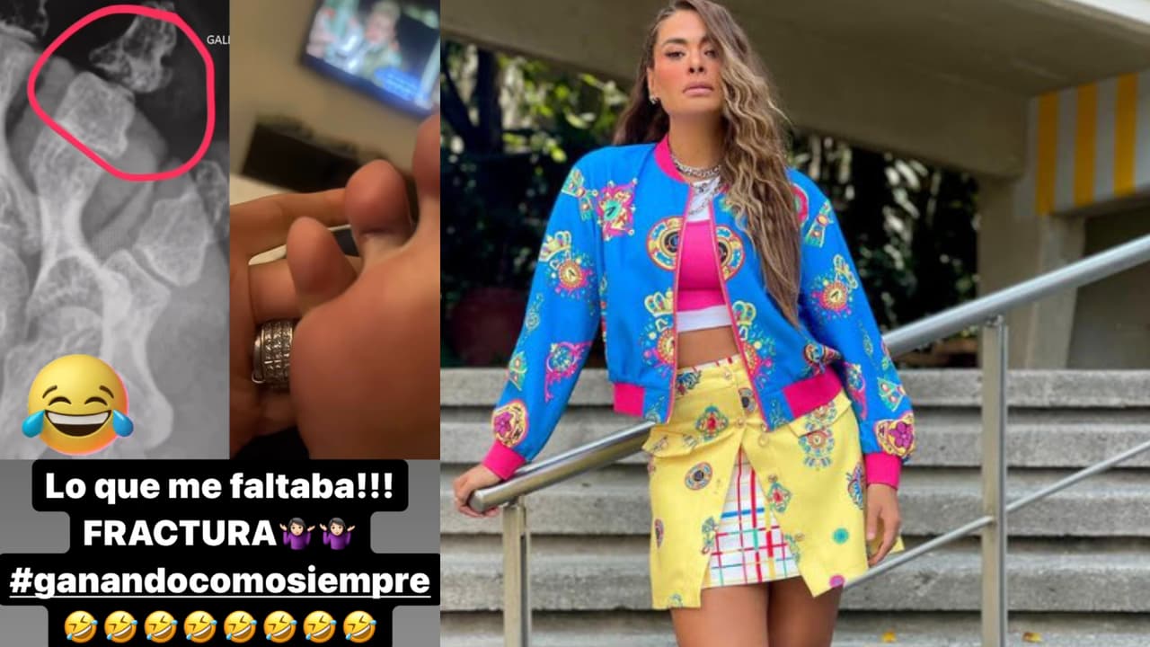 Galilea Montijo mostró las consecuencias de su accidente en Hoy.