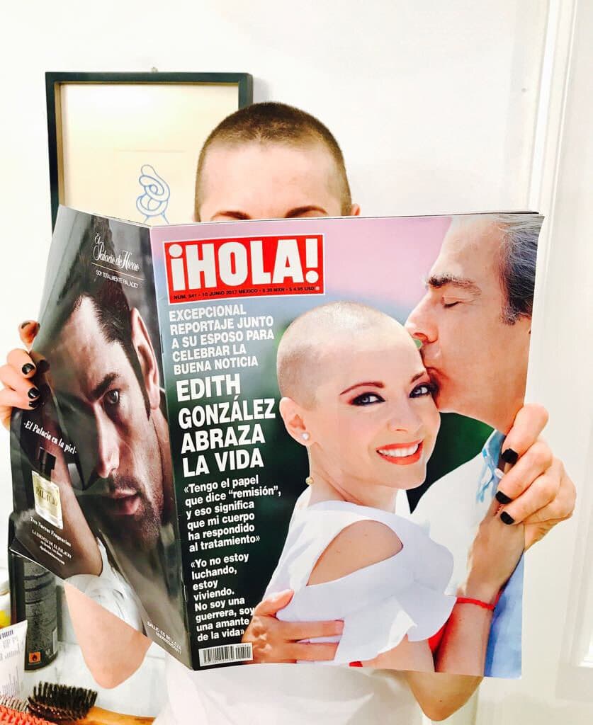 <b><a href="http://www.univision.com/temas/edith-gonzalez">Edith González</a></b> anunció en la revista '¡Hola!' por primera vez que había perdido el cabello y se mostró al natural, pero antes de eso la actriz se dejó ver con pelucas cortas, aunque esto no fue por mucho tiempo.