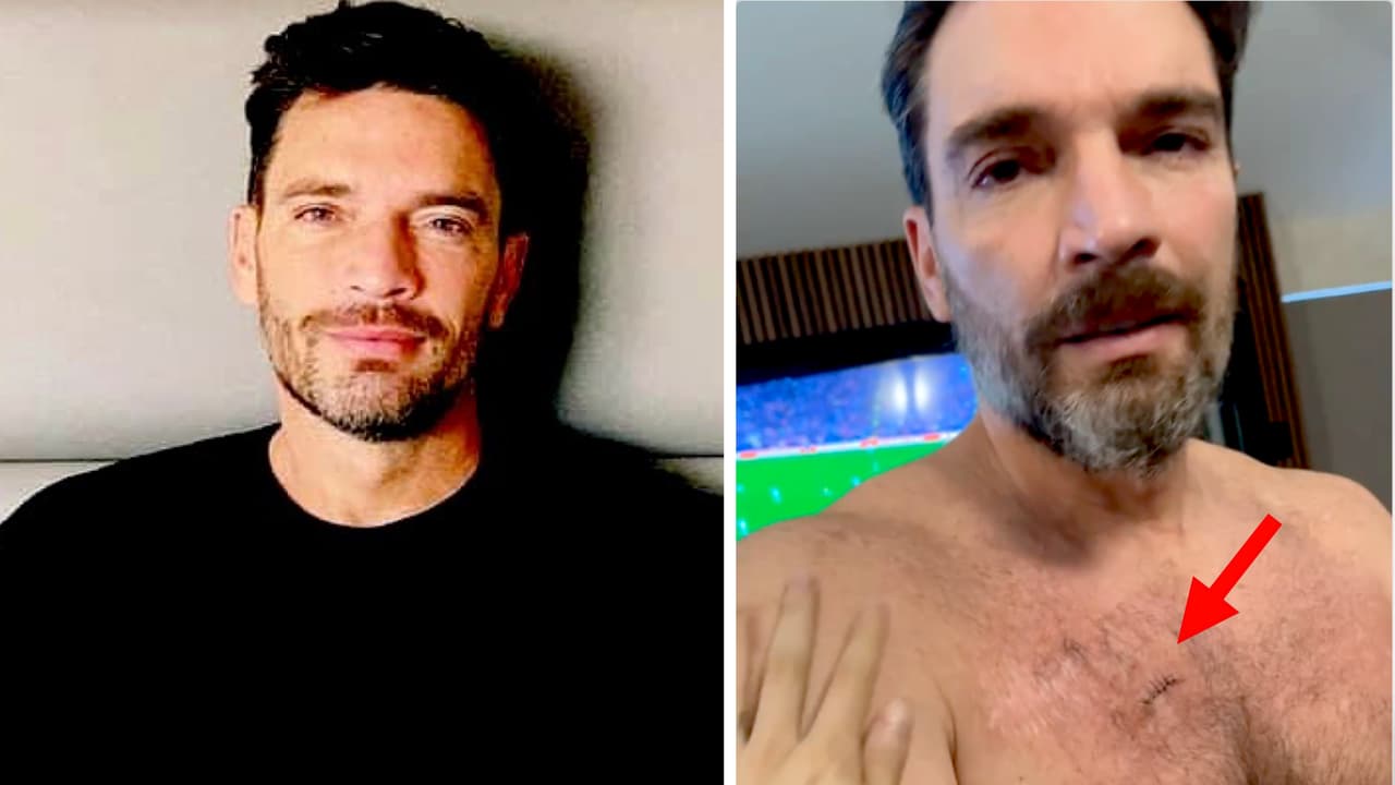 Julián Gil preocupado por su salud luego de sufrir aparatoso accidente, ¿volvió el cáncer?