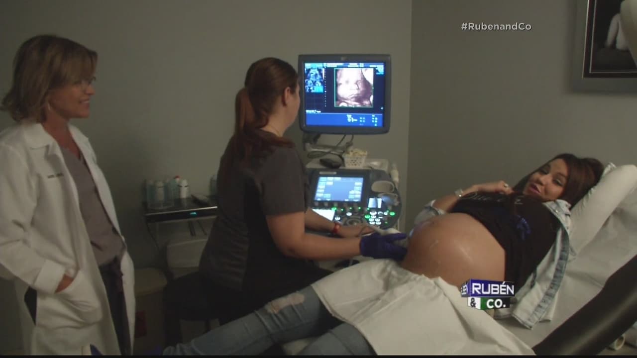 En Rubén & Co pudimos ver en 4D a #BabyCompany, la pequeña Kamilia que está en la barriguita de Gredmarie