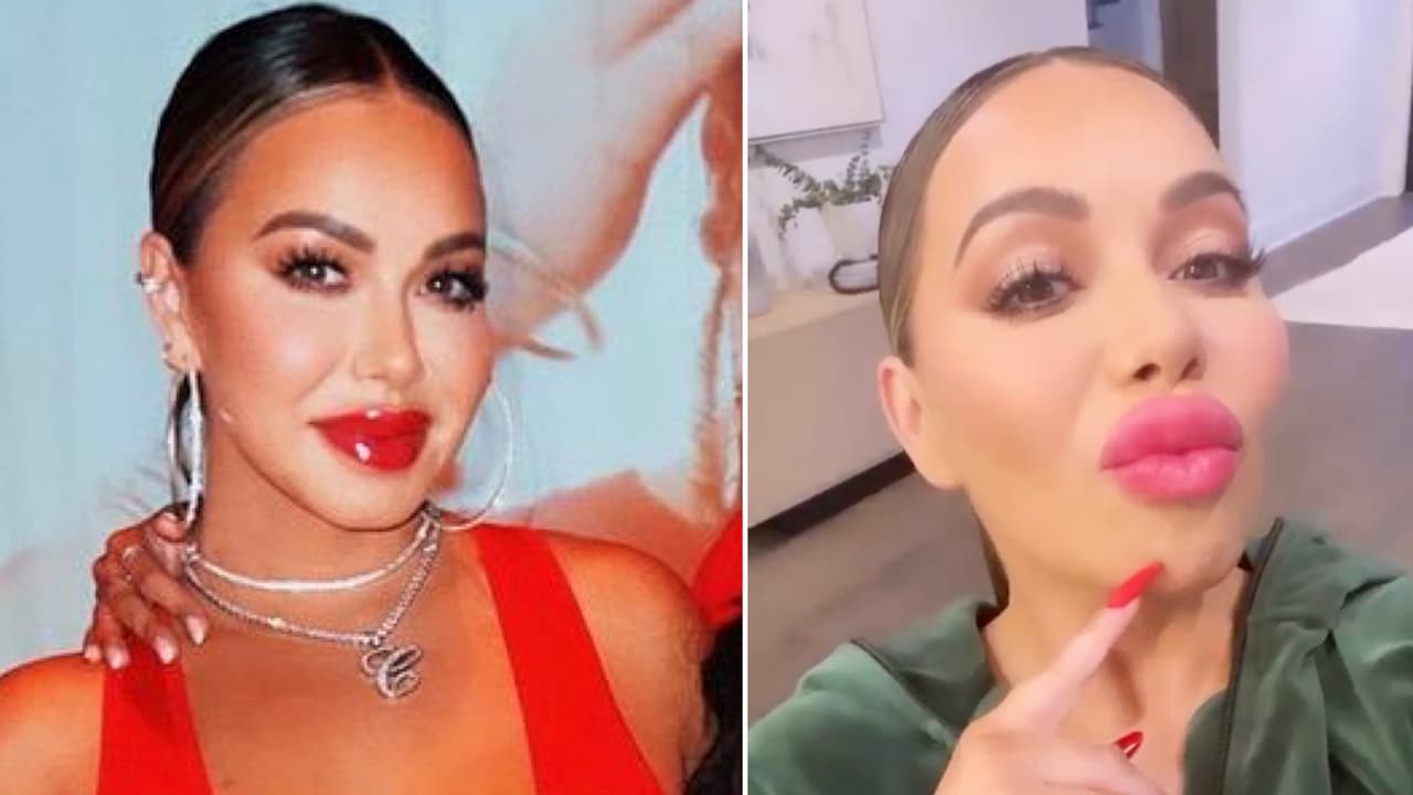 Chiquis se “tatuó” los labios y le quedaron muy grandes: no esperaba que terminaran así