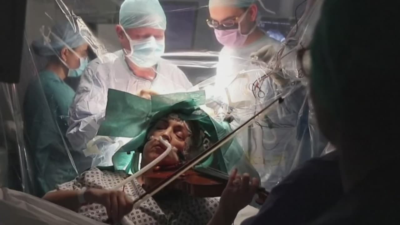 Toca el violín mientras le extirpan un tumor cerebral: "La idea de perder mi habilidad de tocar era desgarradora"