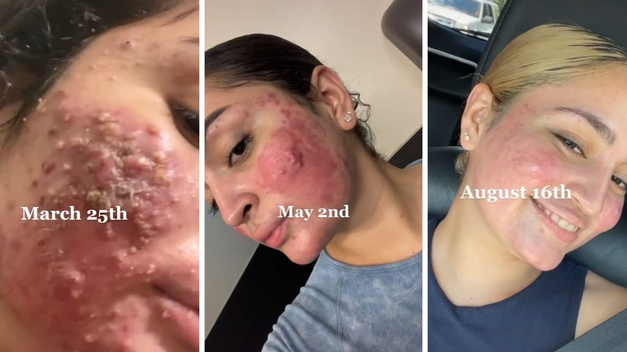 Su rostró tuvo una trasnformación única