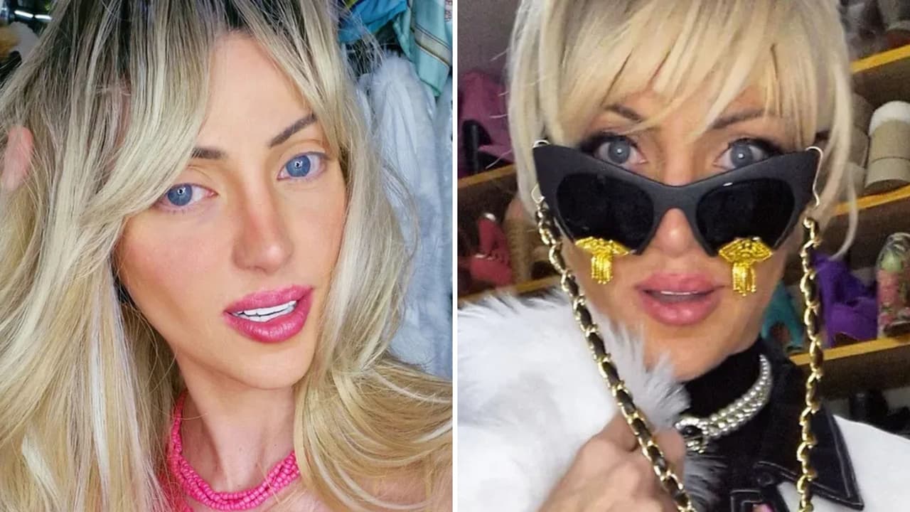 Muere la ‘Barbie humana’ brasileña en extrañas circunstancias: llevaba 27 cirugías estéticas