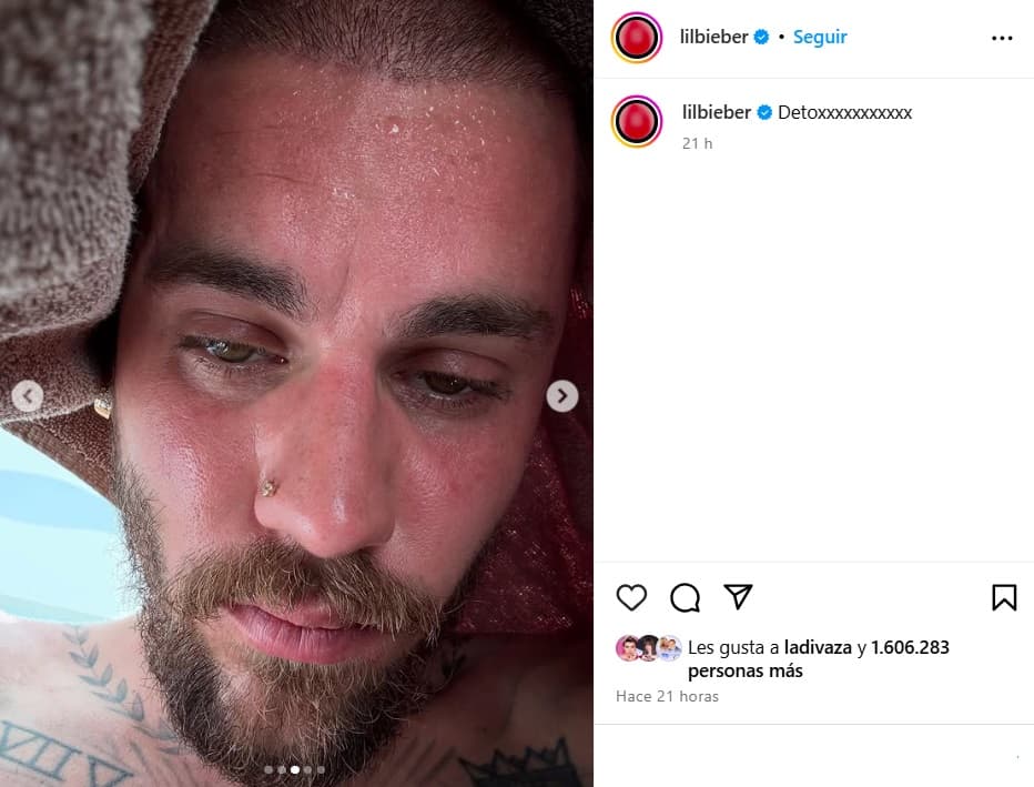 Justin Bieber compartió un 'post' sobre su "desintoxicación".