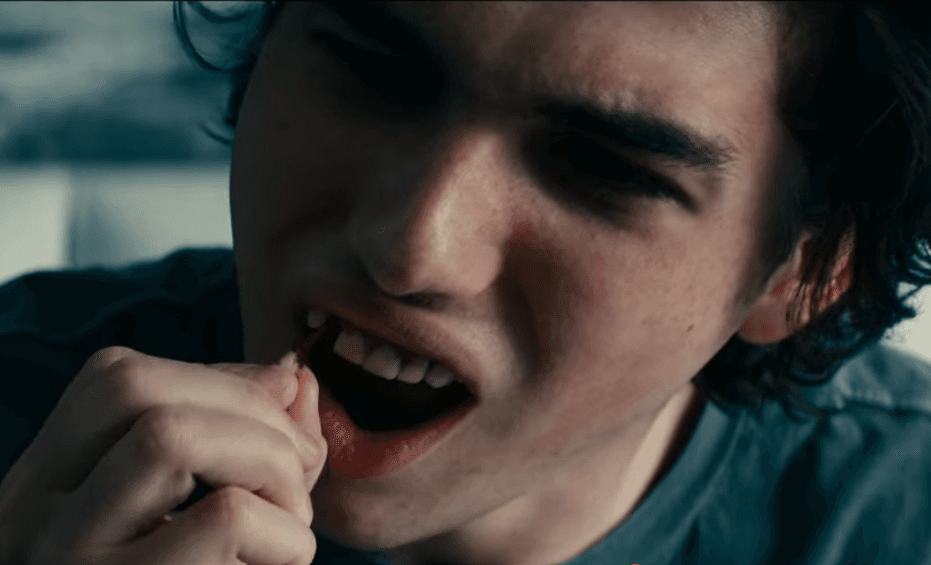 Archie pierde sus dientes en 'Dejar el mundo atrás'