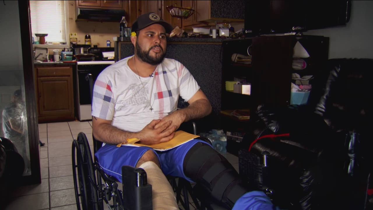 “Pasó su carro por encima de mis pies” hombre queda herido tras discusión con un supuesto rival en casa de su ex pareja