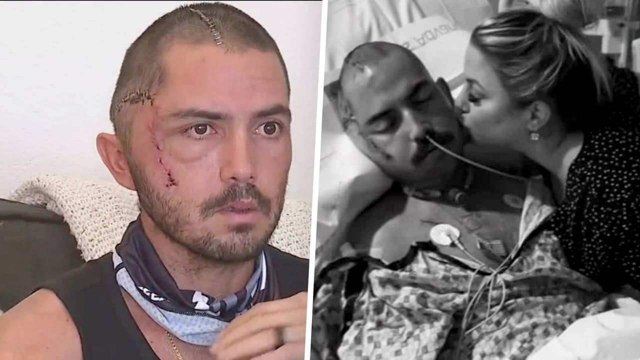 “Sentí los dientes”: hombre narra con terror que fue mordido en la cabeza por un caimán