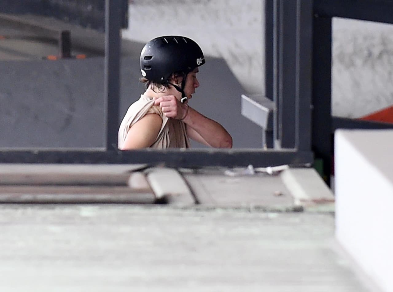 Se levantó las mangas de la playera.