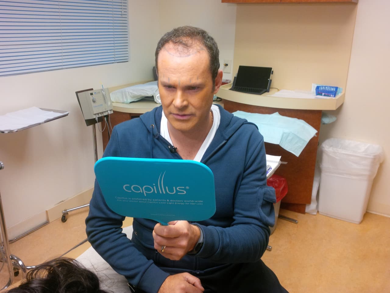 Alan Tacher se injertará cabello