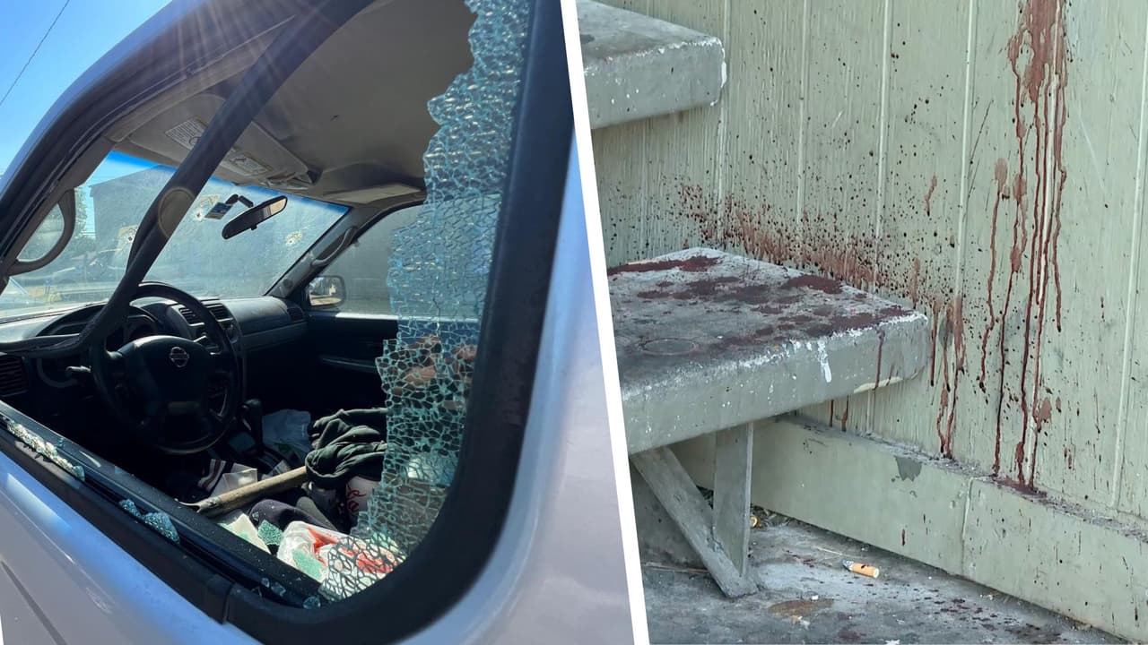 Sospechoso abre fuego desde un auto, mata a uno y deja tres heridos en North Dallas